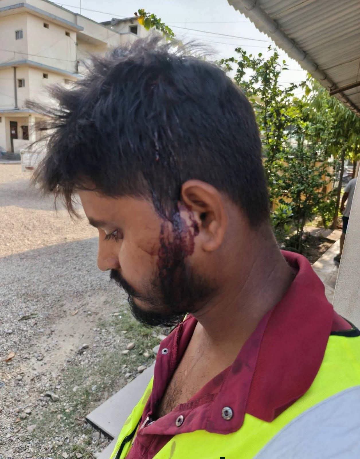 गुणस्तरहीन निर्माणबारे समाचार संकलन गर्न पुगेका पत्रकारमाथि कुटपिट, प्रेस स्वतन्त्रतामाथि गम्भीर चुनौती